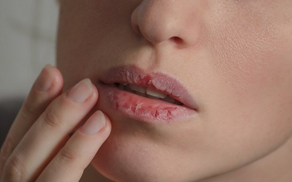 coco lips tái tạo môi hồng tự nhiên đặt vấn đề