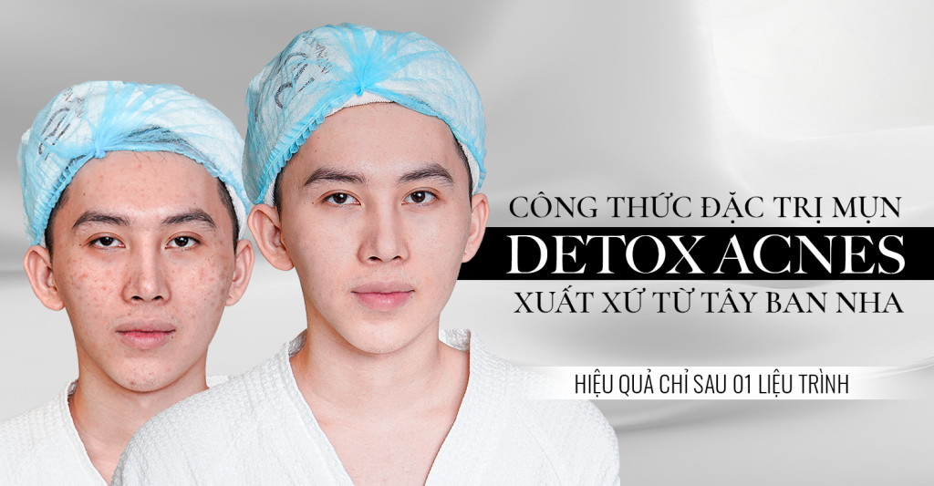 mụn tuổi dậy thì detox acnes tây ban nha