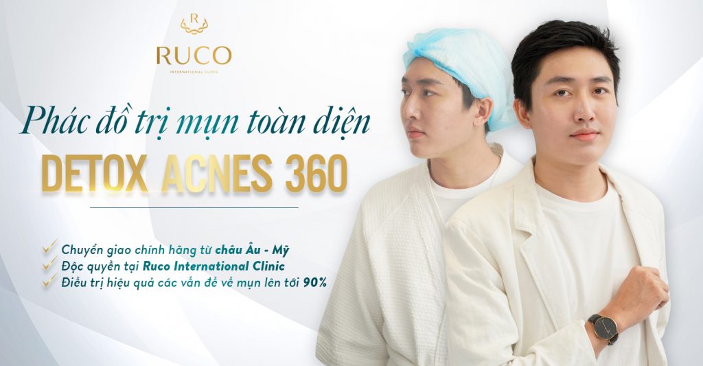 cách trị mụn bằng phác đồ điều trị detox acnes 360