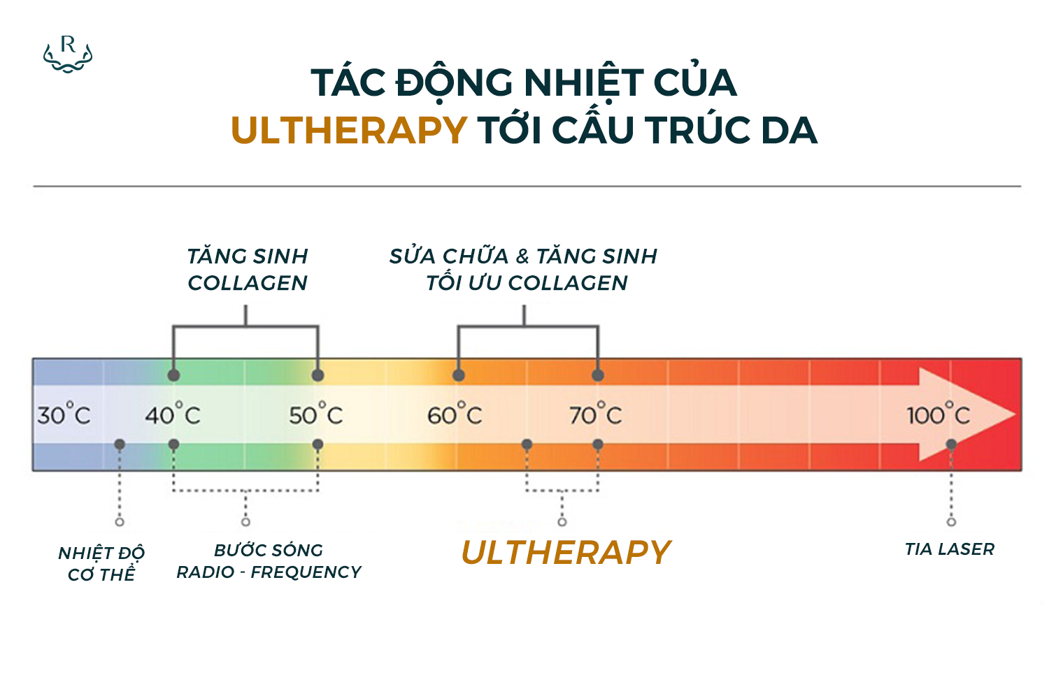 Tác động nhiệt của Ultherapy tới cấu trúc da