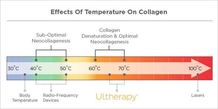 ruco ultherapy ảnh hưởng nhiệt độ đến collagen