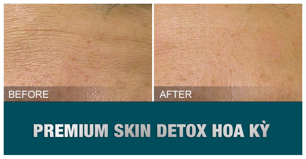premium skin detox hoa ky before after 1