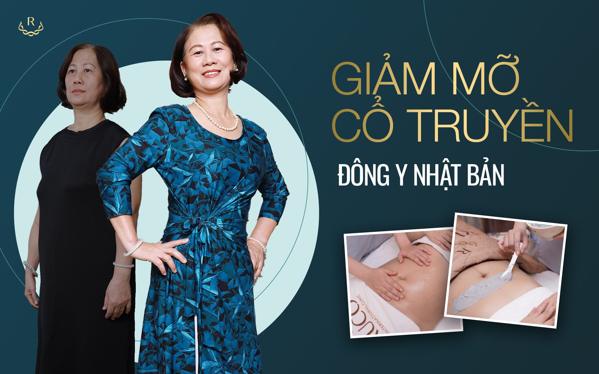 Giảm béo đông y là gì?
